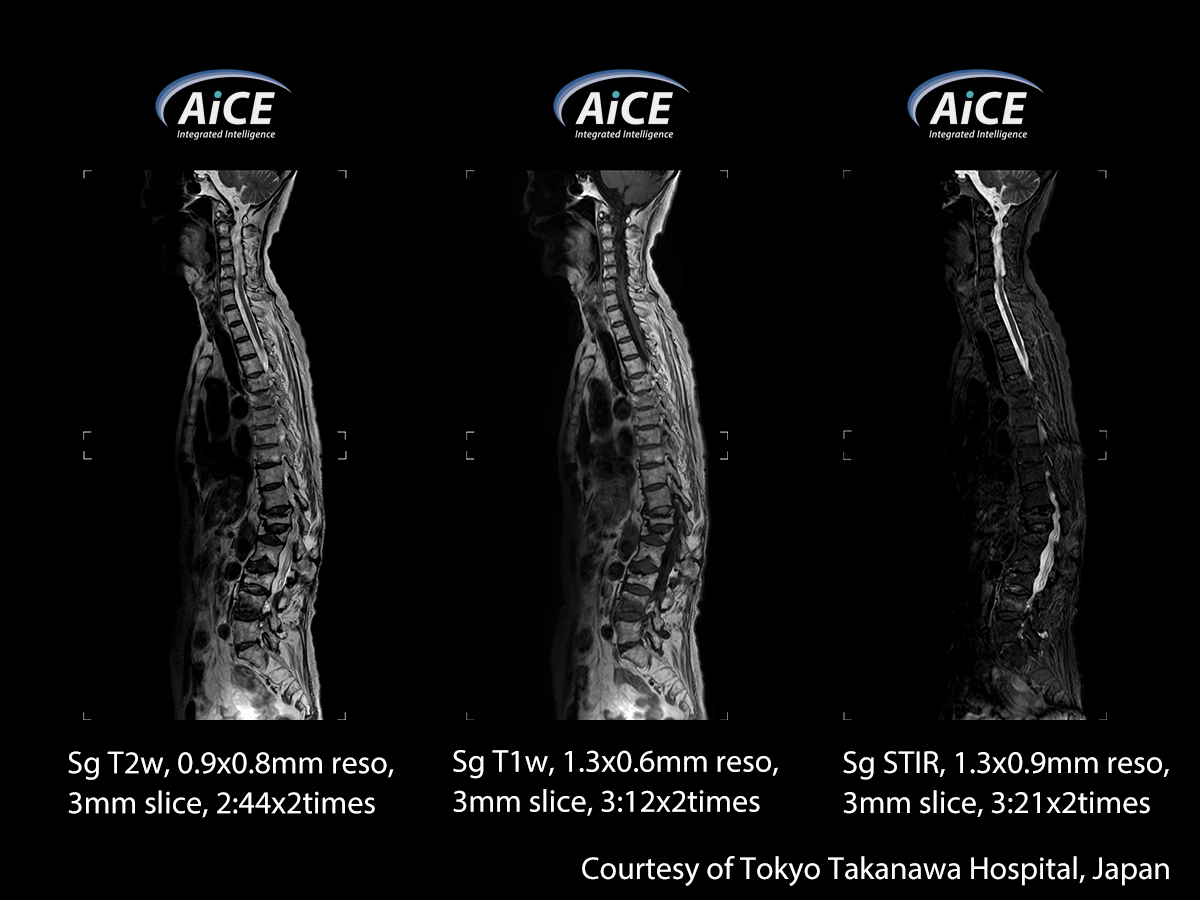 Advanced intelligent Clear-IQ Engine Spine