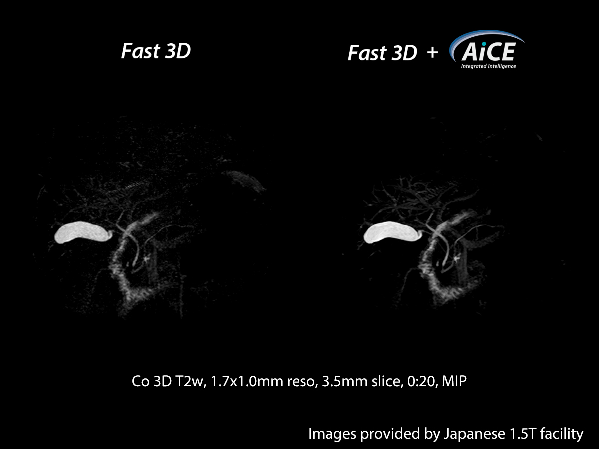 Advanced intelligent Clear-IQ Engine Abdomen