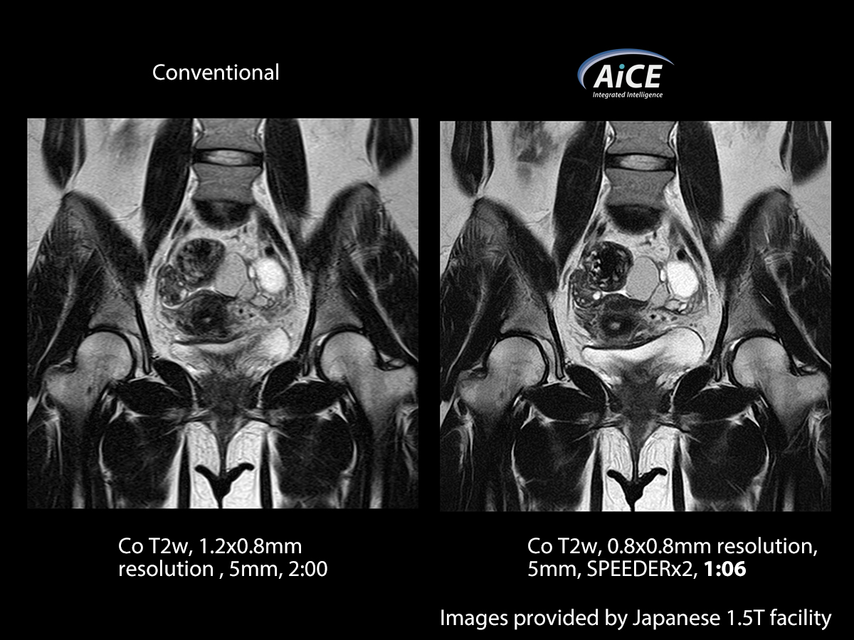 Advanced intelligent Clear-IQ Engine Abdomen