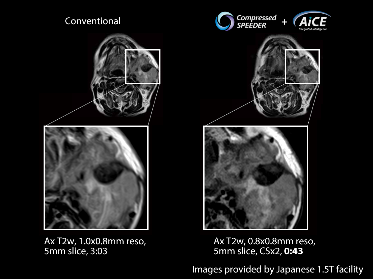 Advanced intelligent Clear-IQ Engine Head