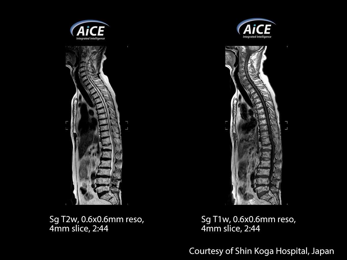 Advanced intelligent Clear-IQ Engine Spine