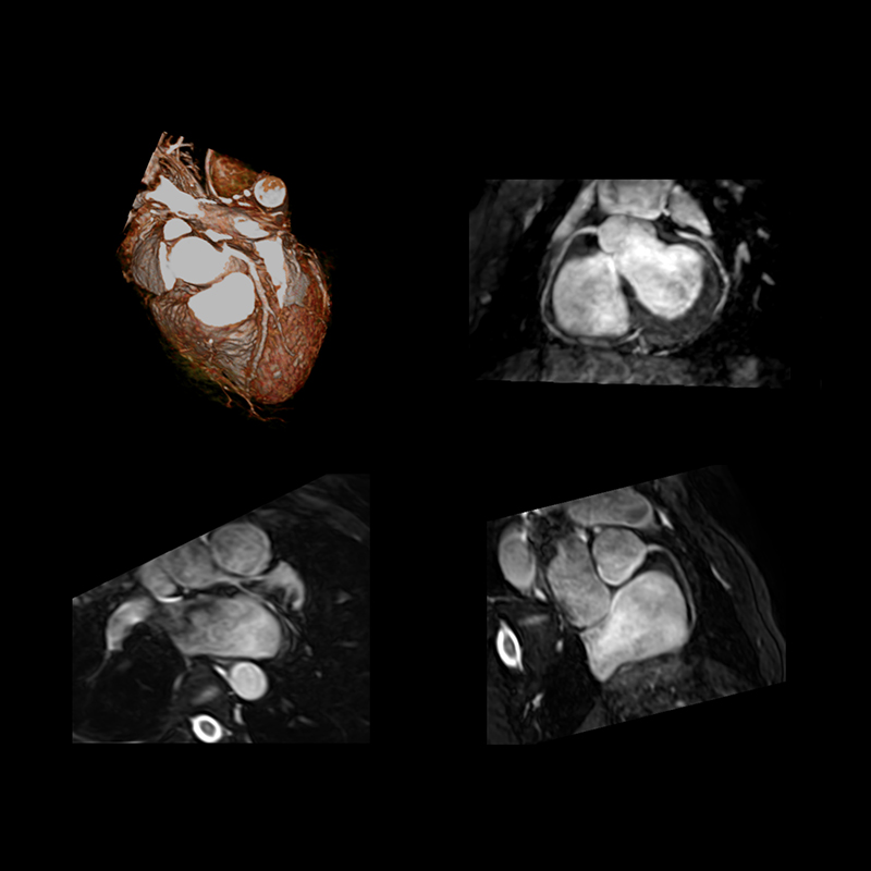 Vantage Elan Body Imaging