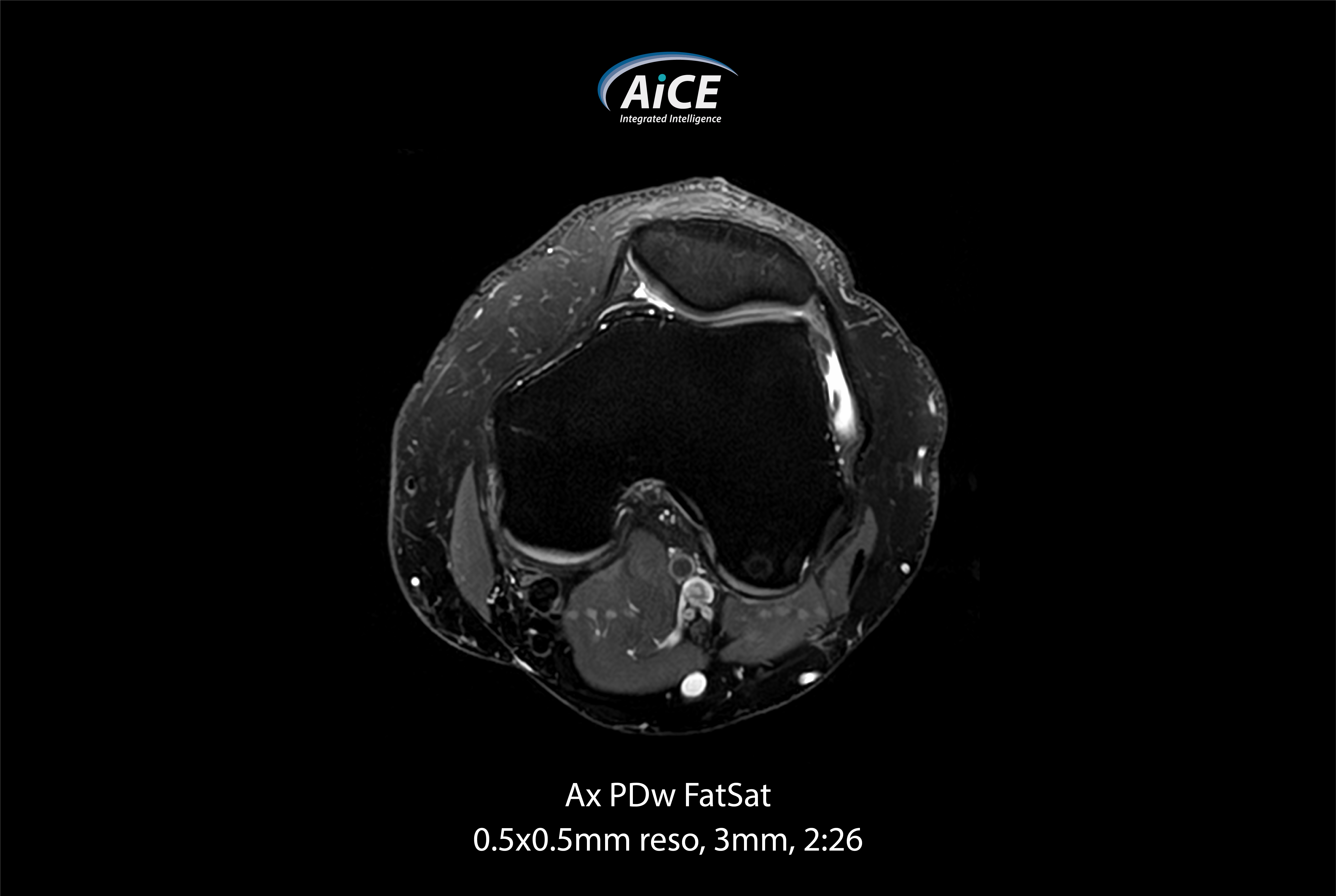 Vantage Elan Knee