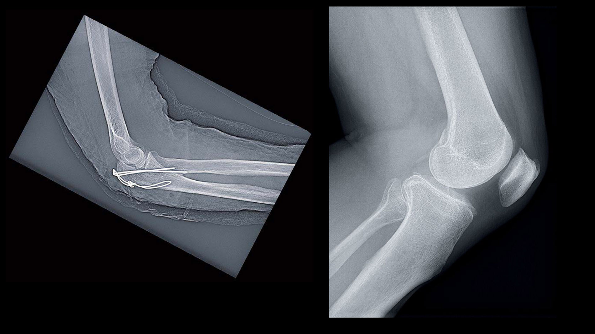 Radrex i5 Clinical images