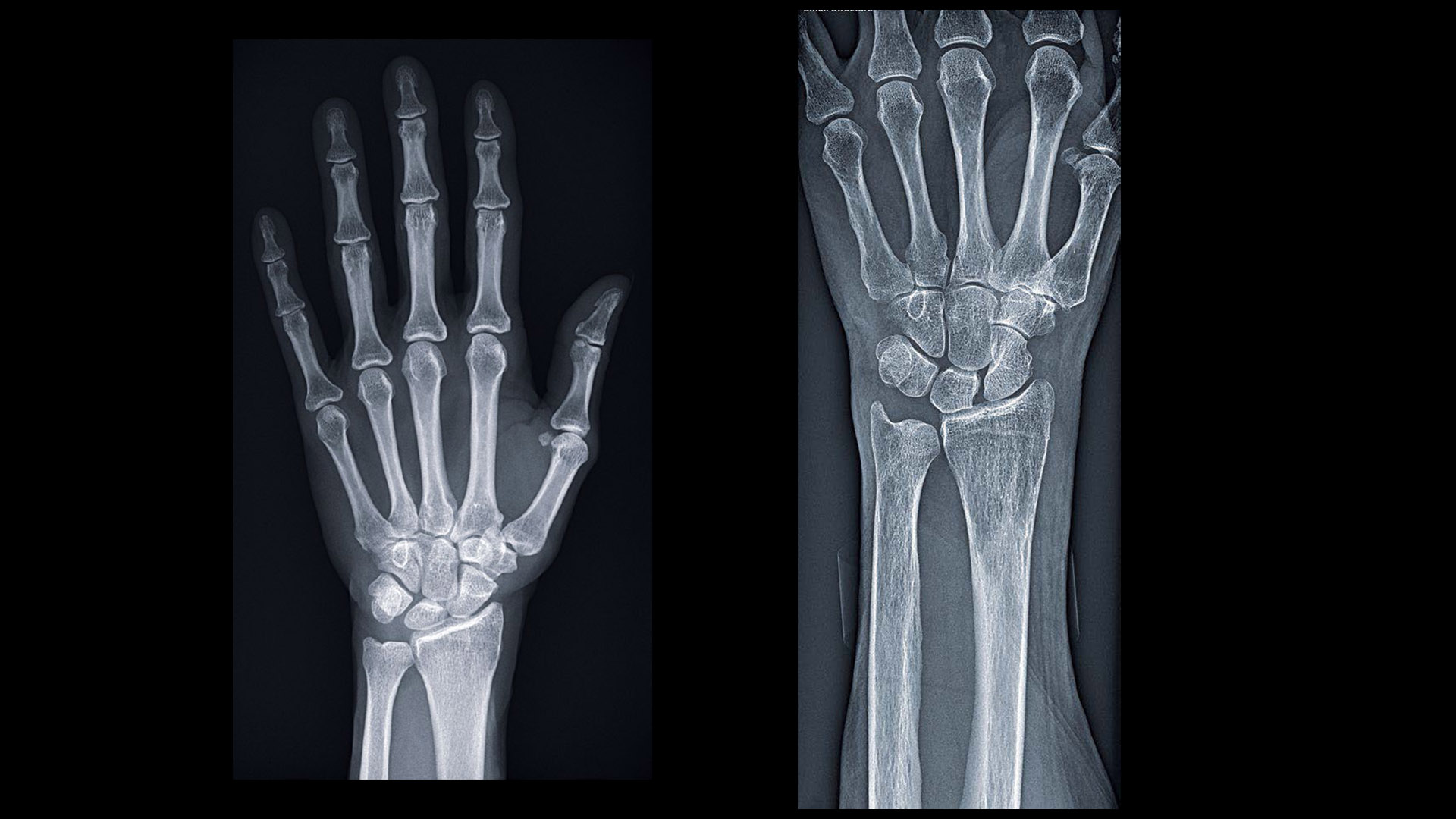 Radrex i5 Clinical images
