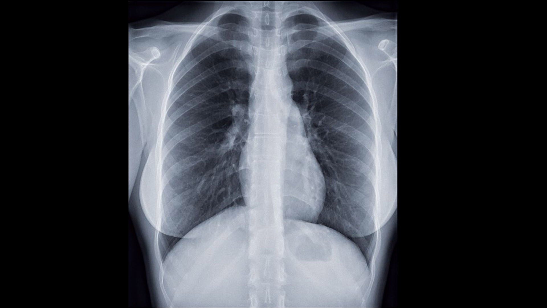 Radrex i5 Clinical images