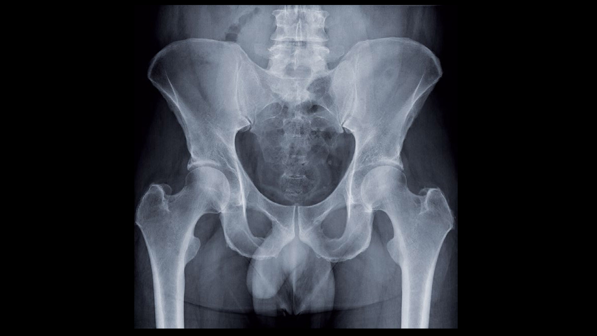 Radrex i5 Clinical images