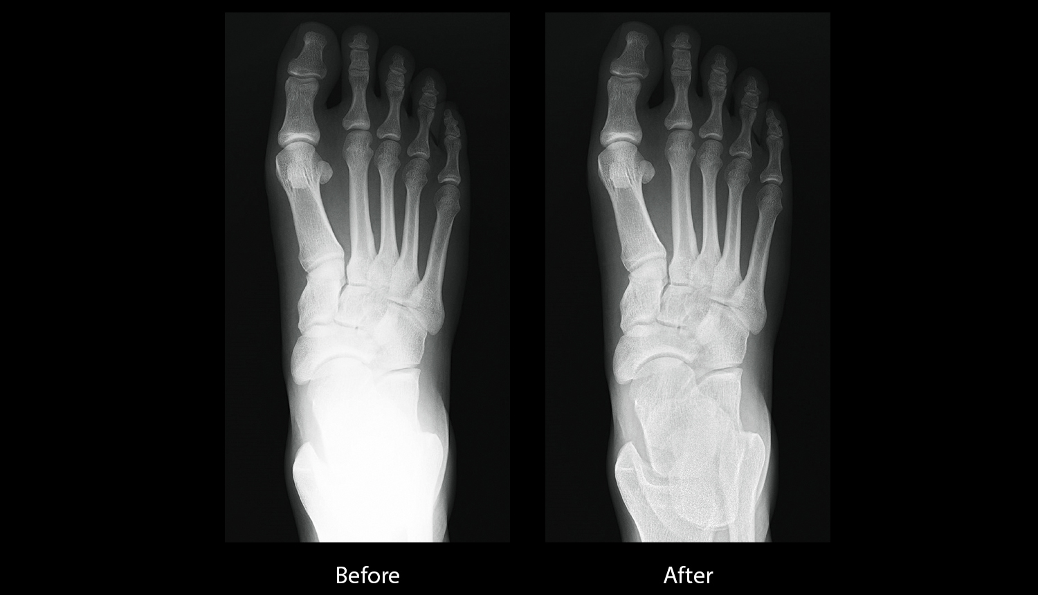 Radrex i5 Clinical images