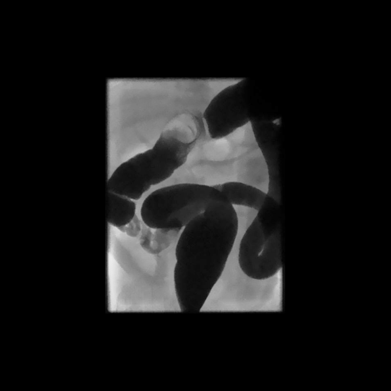 Ultimax-i Barium Enema with Air